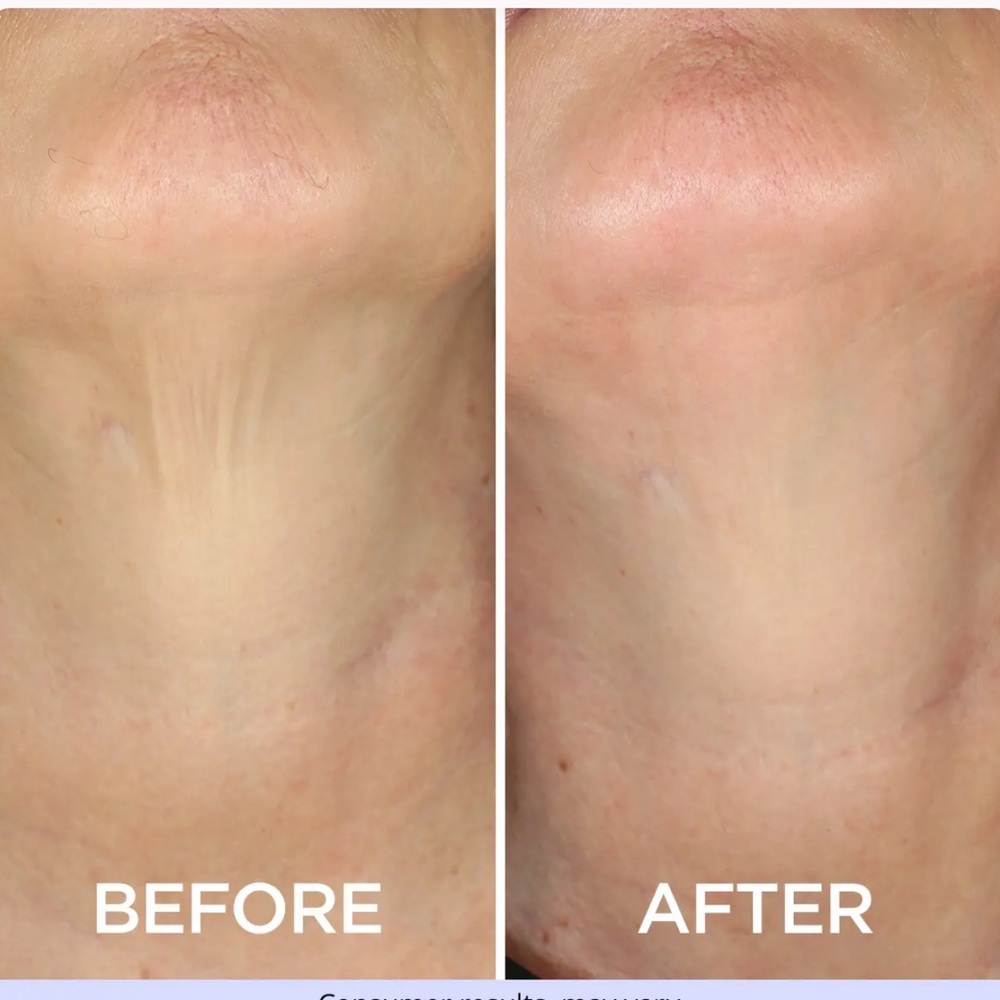 Brand New Set of 3 Go Pure - Tighten and Lift Neck Cream - Picture 10 of 12